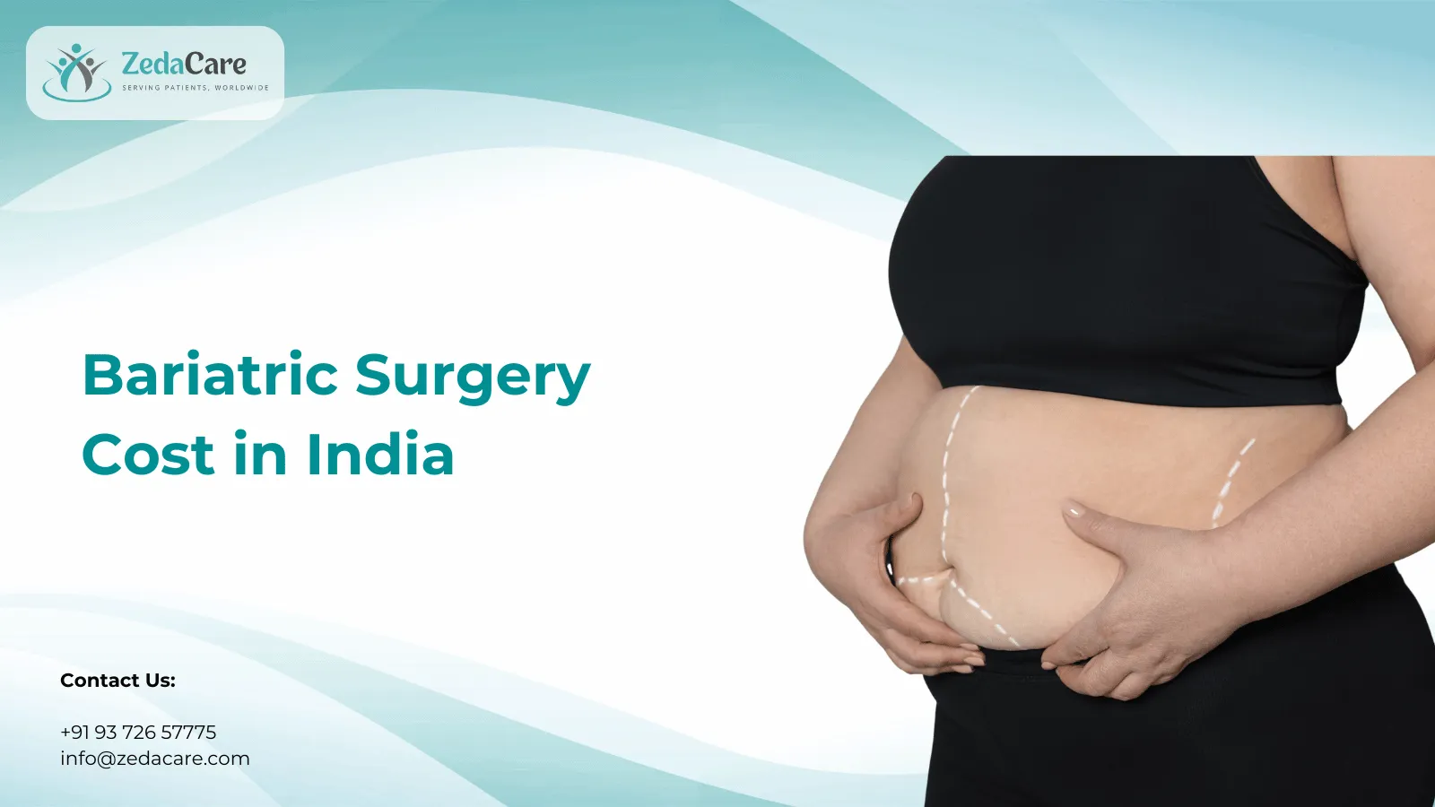 Bariatric and weight loss surgery in India for obesity management